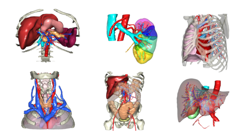 高阶影像培训 _ 3D Slicer 医学影像高级应用及科研培训班鼎湖(第八期)VD103
